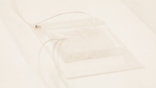 Blood runs through the labyrinth chip, quickly separating cancer cells from white and red blood cells. Image: Joseph Xu, Michigan Engineering Communications & Marketing.