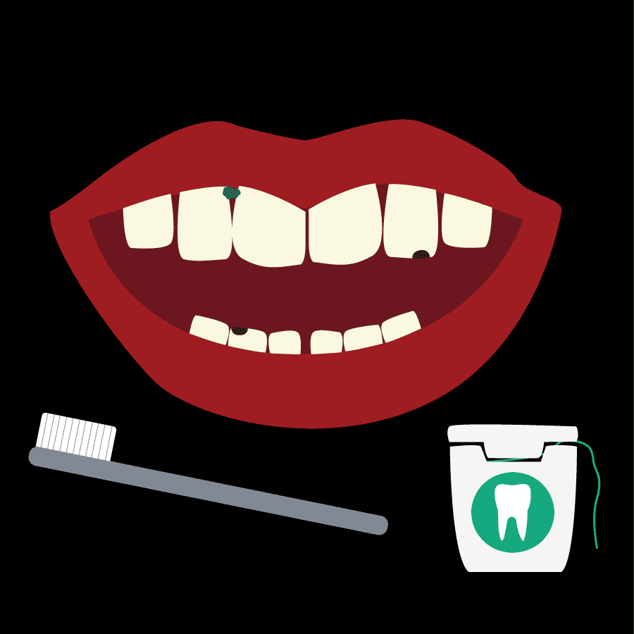 Illustration of teeth with cavity, toothbrush, and floss, created by Katie Beukema