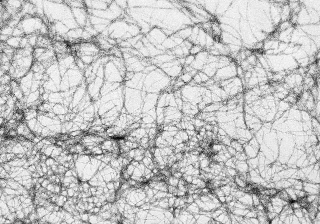 Shown are amyloid fibers made from a peptide derived from the E. coli CsgA protein. All images courtesy: The Chapman Lab
