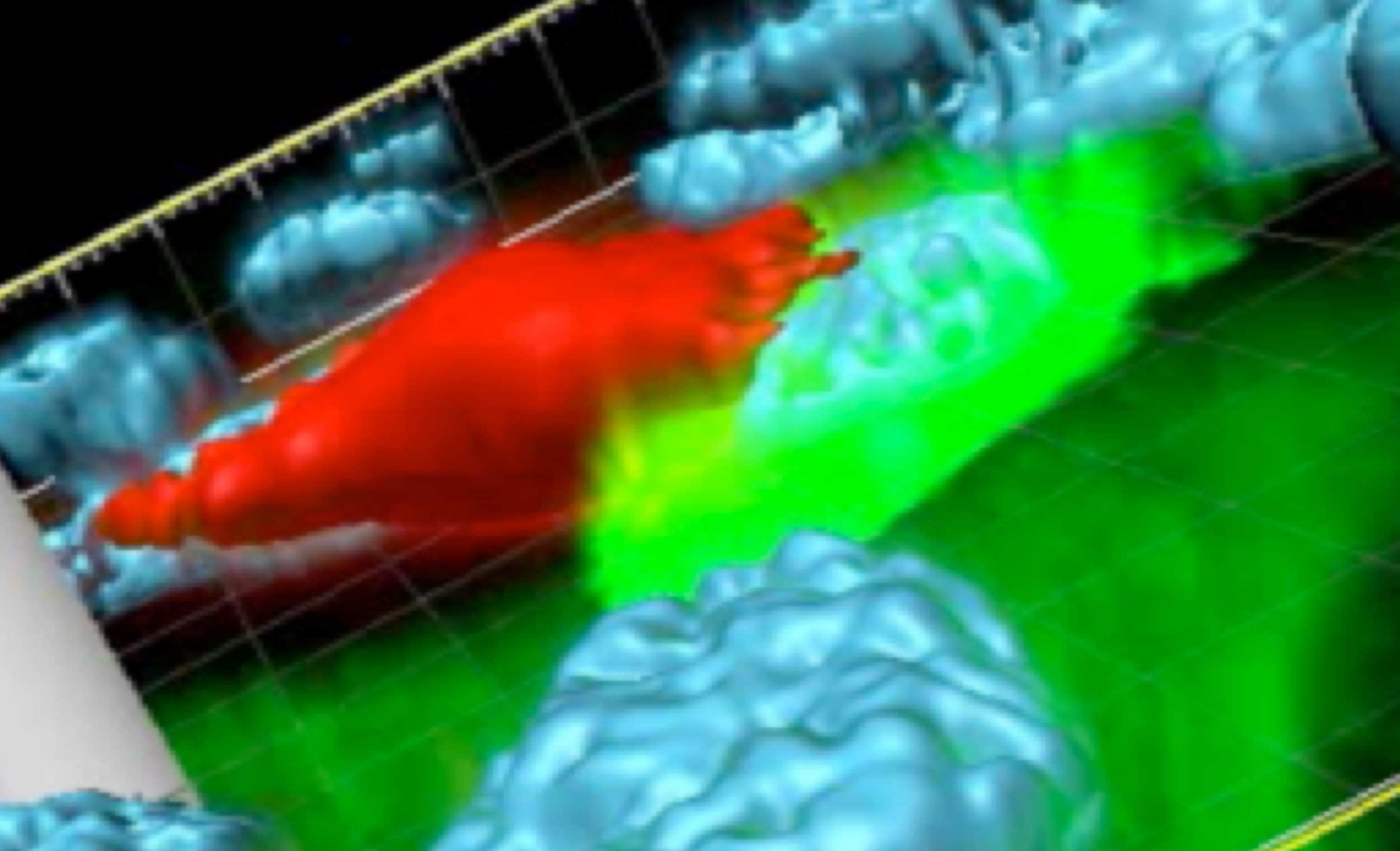 The image depicts a phagocytic cell (red) in the process of engulfing a dying prostate cancer cell (green). Image courtesy Hernan Roca