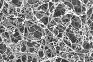 An electron microscope image of the synthetic cartilage matrix. Image credit: Lizhi Xu, Kotov Lab