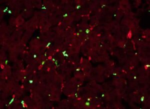 Neutrophils (red) arrest plastic nanoparticles (green) from the bloodstream and deliver them to the liver of a live mouse for disposal. Image credit: Catherine Fromen, Cell Adhesion & Drug Delivery Lab