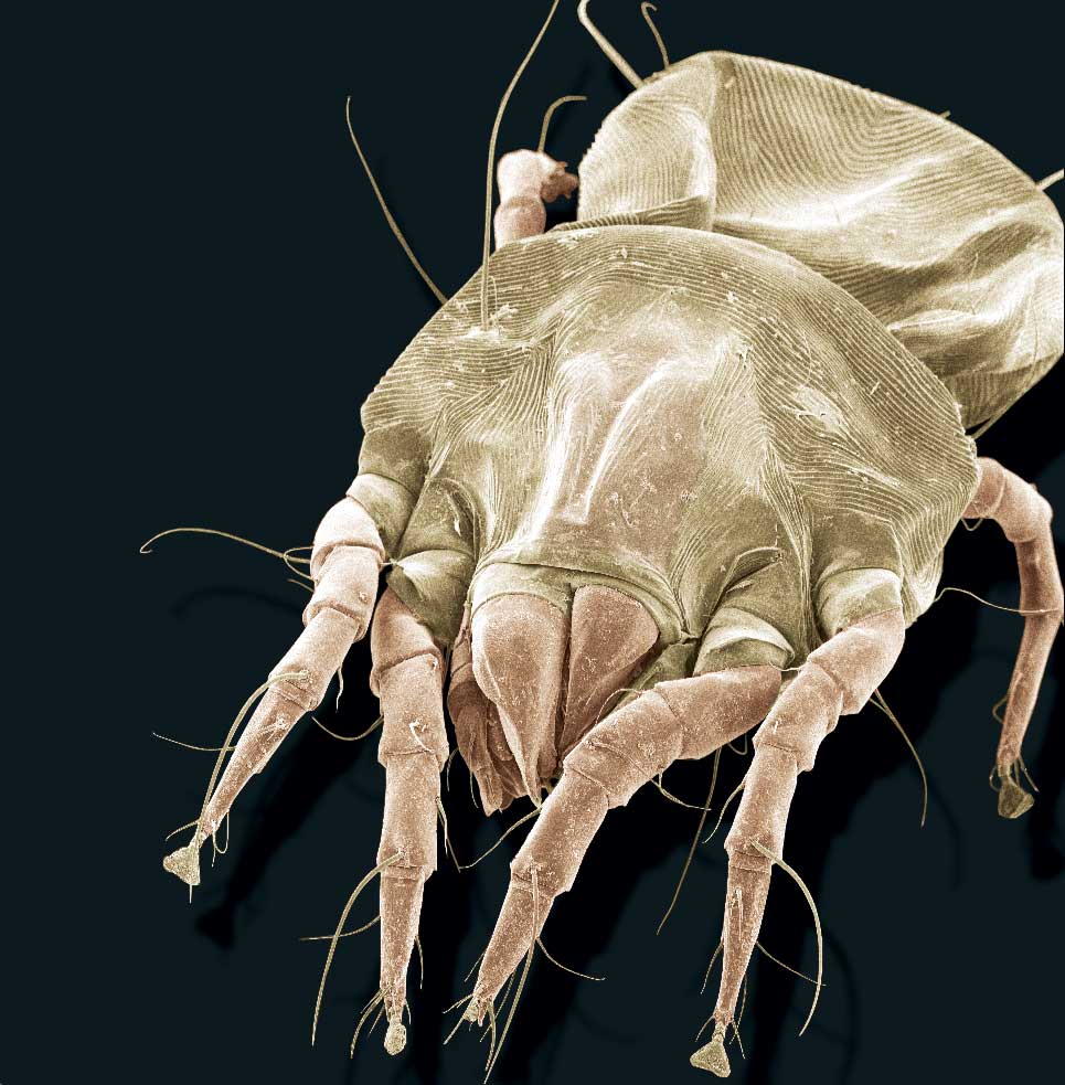 A scanning electron microscope image of an American house dust mite, Dermatophagoides farinae. Image credit: Ellen Foot Perkowski