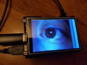 The image Molly Fausone sees on her mobile device as she examines patients with the device. Image credit: David Lorch