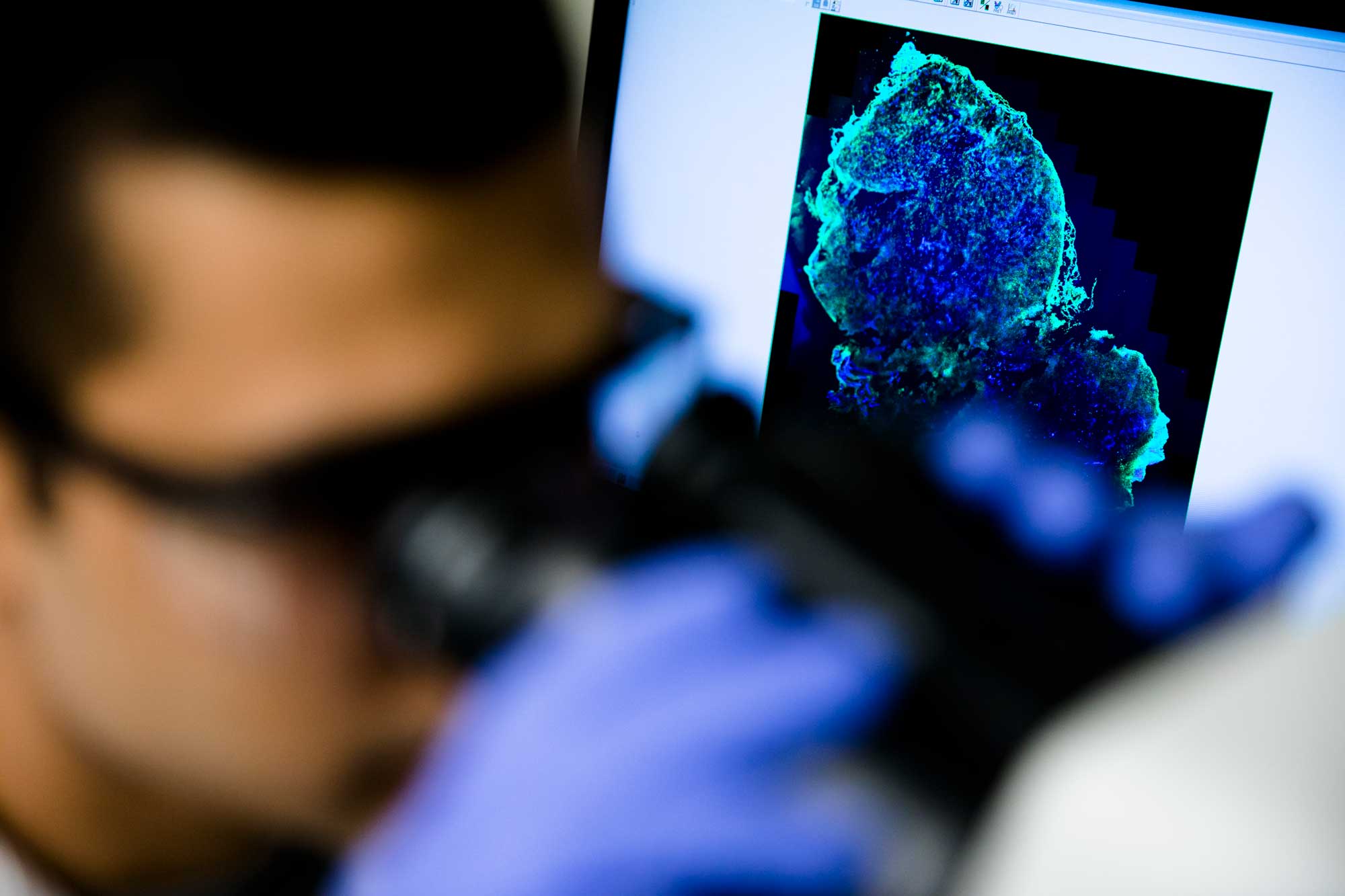Sumit Bhatnagar, a PhD student in chemical engineering, inspects and analyzes tumor cells used in his research developing a diagnostic screening pill for breast cancer and other diseases under the direction of Greg Thurber, an assistant professor in chemical engineering. The pill would contain a fluorescent imaging agent connected to a targeting molecule that binds to cancerous cells in breast tissue, in order to make earlier and more accurate breast cancer diagnoses. Image credit: Evan Dougherty, Michigan Engineering