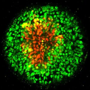 A disc-shaped colony in which neural plate cells are marked by red fluorescent tags, while the neural plate border cells are tagged with green. The new study suggests that human embryonic stem cells differentiate into neural plate or neural plate border cells based in part on the physical signals they perceive while differentiating. Image: Xufeng Xue, Integrated Biosystems and Biomechanics Laboratory, University of Michigan.