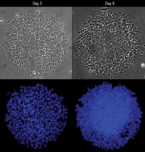Disc-shaped colonies shown with phase contrast (top) and fluorescence (bottom) microscopy. Between day 3 and day 9, cells in the center of the colony grow faster and become much more densely packed. Confined space drives the cells in the center of the colony to become neural plate cells, whereas those cells at the colony border (experiencing less confinement) differentiate into neural plate border cells. Image: Xufeng Xue, Integrated Biosystems and Biomechanics Laboratory, University of Michigan.