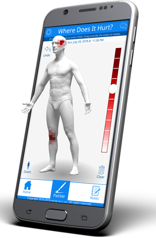 Illustration of the GeoPain app