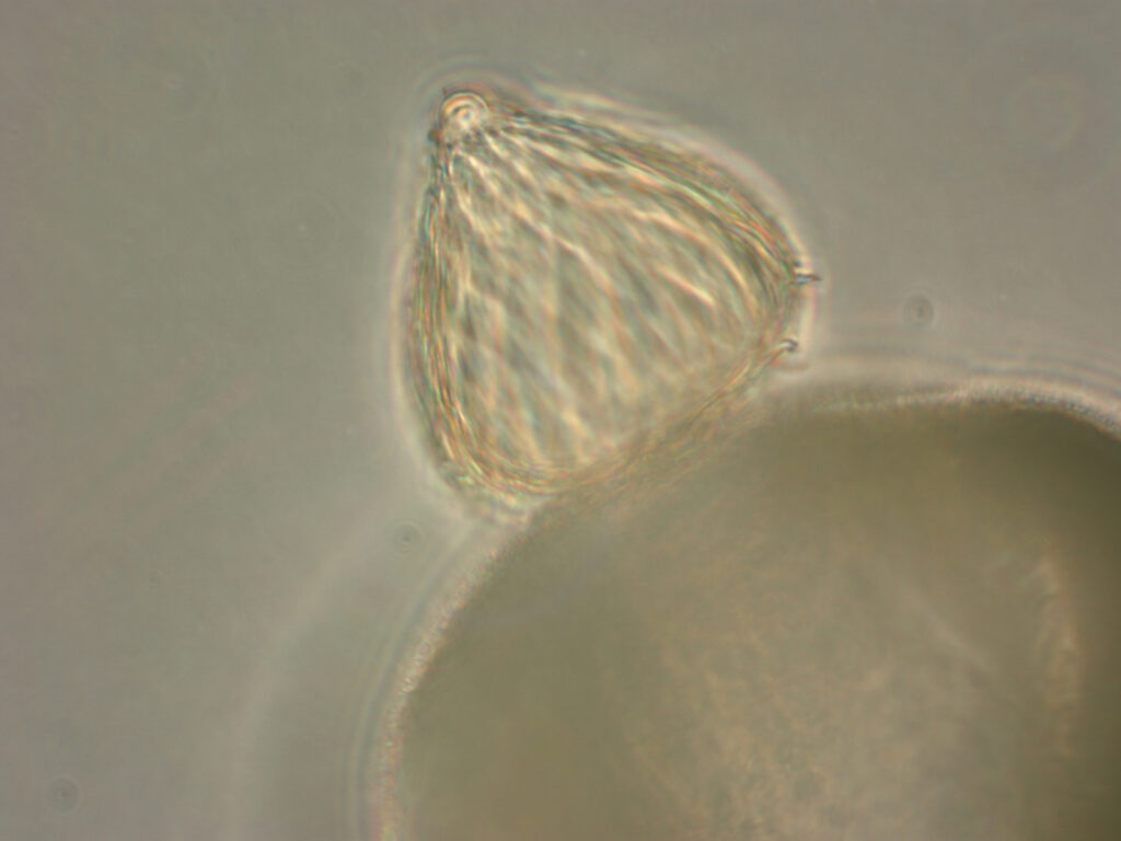 Blyttiomyces helicus on spruce pollen grain. Image credit: J.E. Longcore