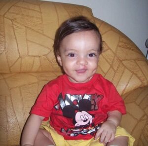 Arthur after his first surgery.