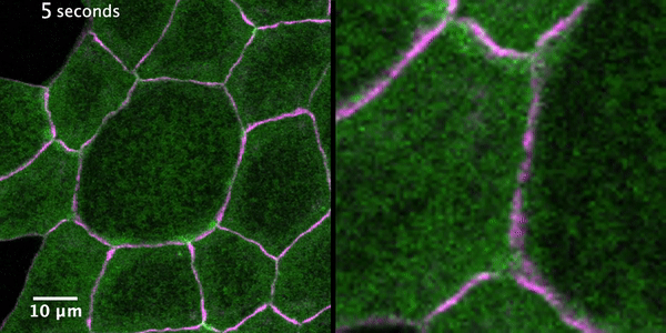 As epithelial cells move and change shape, the junctions between these cells can develop gaps, resulting in a leaky barrier. Bursts of Rho activity (called Rho flares, white arrows) occur at the sites of breakage and are used to signal for the repair of leaky junctions. The movie on the right is an enlargement of a Rho flare from the movie on the left. Green: a fluorescent reporter for active Rho. Magenta: fluorescently tagged ZO-1, a junction protein. Animation credit: Rachel Stephenson