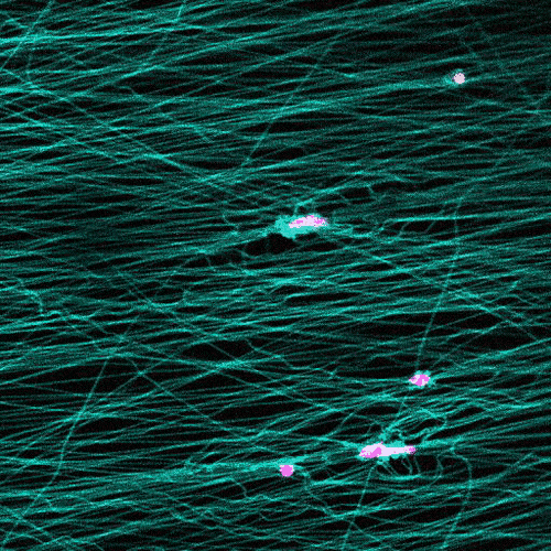 Under a microscope, cells stretch and subsequently “slingshot” forward. Biomedical engineering researchers at the University of Michigan documented this rapid movement, a migration as much as five times faster than previously observed. Image credit: Brendan Baker and William Wang.