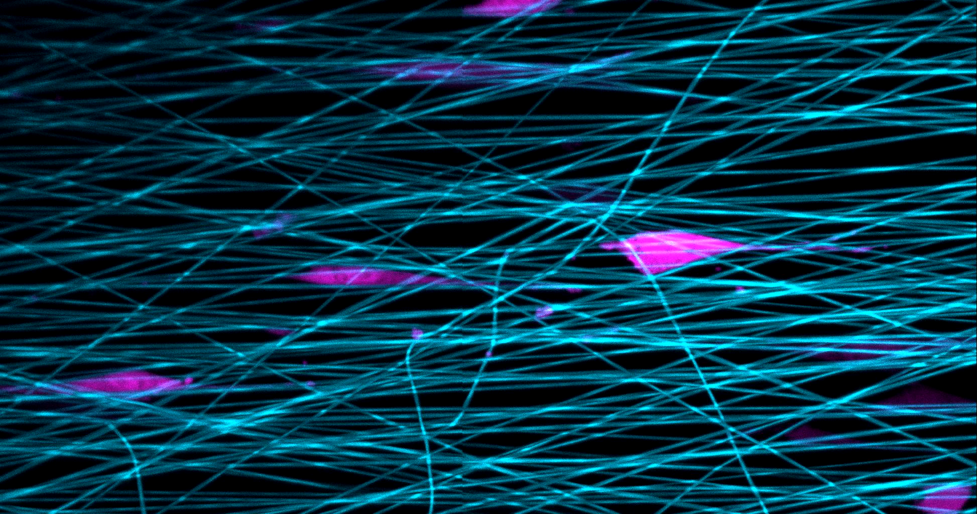 Human fibroblast cells (pink) in the process of slingshotting themselves forward in a 3D scaffold designed to mimic the conditions of the body (blue). Fibroblasts are the most common cells found in connective tissue. Biomedical engineering researchers at the University of Michigan documented this “slingshot migration,” which is five times faster than any other previously documented type of cell movement.