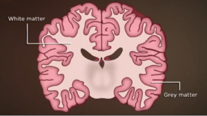 Brain view