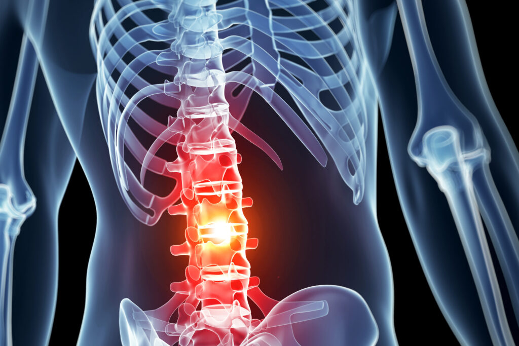 Illustration of the human body showing the skeletal system, with the lower spine highlighted in red to indicate pain spots. Image courtesy: Michigan Engineering