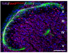In this image of a spinal cord, components of the neuron circuitry that transmits mechanical itch are lit by fluorescent markers. The small pink dots are the nerveterminals of the receptor called toll-like receptor 5-positive low-threshold mechanoreceptor. The larger magenta circles are Ucn3 neurons. The line of green is the nerve terminals of nociceptive sensory neurons—neurons responsible for sensing pain. Image credit: Bo Duan