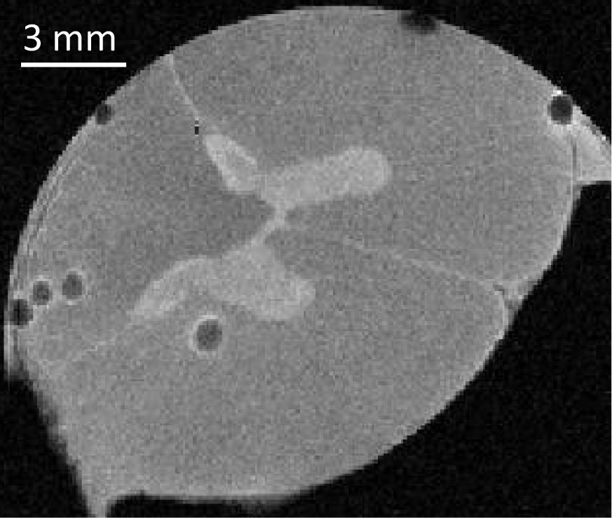 Pictured is an MRI image of decompression bubbles in the spinal cord. The center shows the gray matter, surrounded by white matter where› the bubbles preferentially form. The small black circles are nitrogen bubbles. Image credit: Jens-Christian Meiners