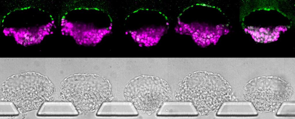 A set of five embryo-like structures in a microfluidic device developed in the lab of Jianping Fu. The top row consists of “immunostaining” images in which key proteins are tagged with dyes to label different cell types, whereas the bottom row shows standard photos taken through a microscope. Parts of the bottom images were blurred to more clearly show a correlation between the rows. Image credit: Fu Lab, Michigan Engineering