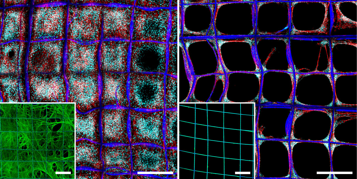 On the left, cells leverage the fibronectin network to build colonies that span whole compartments, each half a millimeter across. The inset shows how the fibronectin bridges within and between individual compartments. On the right, balled-up fibronectin is coated onto the structure in the conventional way, as shown in the inset. The cells are somewhat successful at building 3D colonies at the corners, but the interiors of the compartments are barren. Image credit: Stacy Jordahl, Lahann Lab