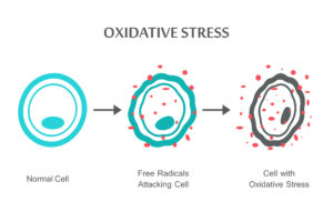 Oxidative Stress Diagram. Normal Cell, to the Free Radicals Attacking the Cell, to a Cell with Oxidative Stress. Image Credit: iStock