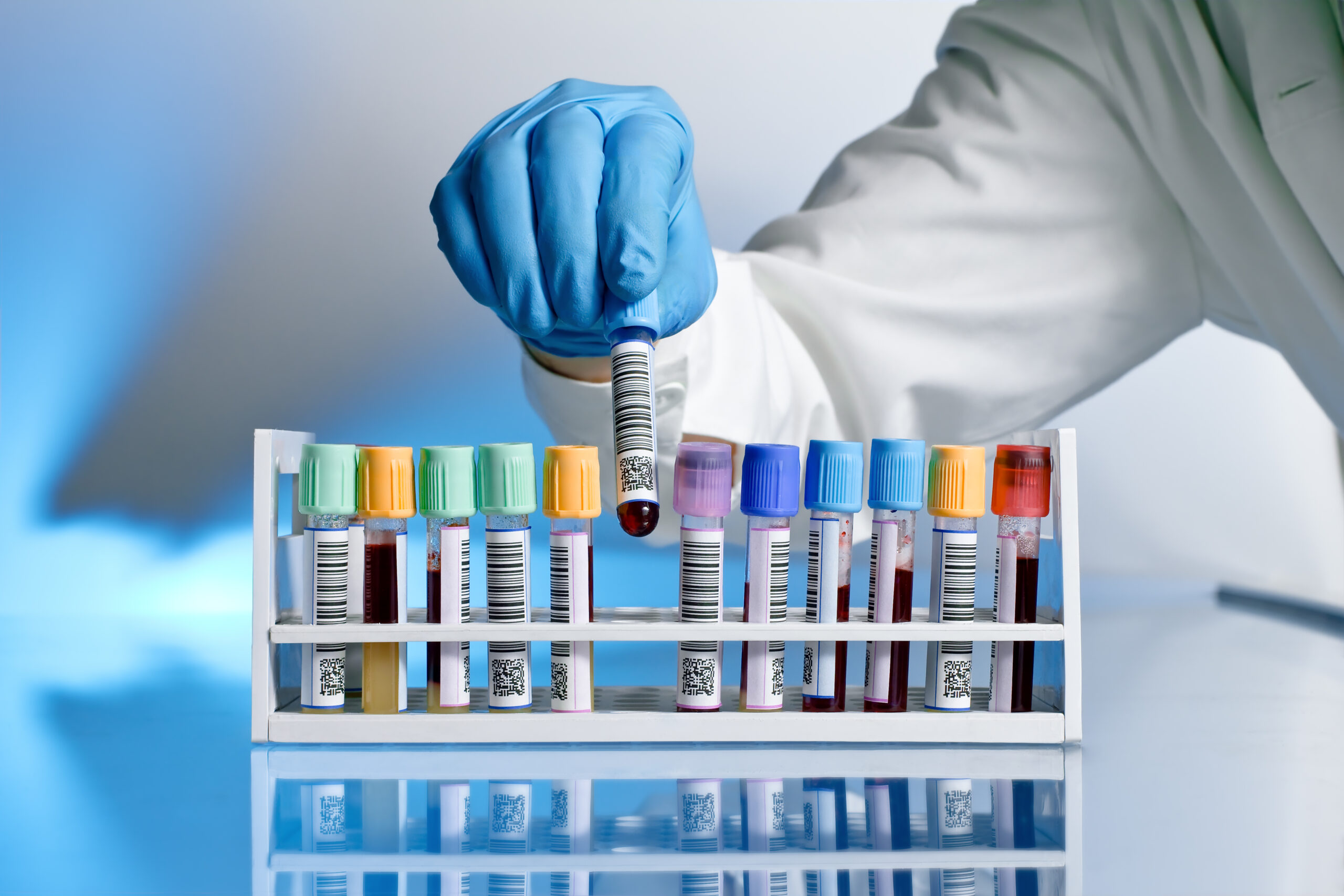Hand of doctor taking blood sample. Image credit: iStock