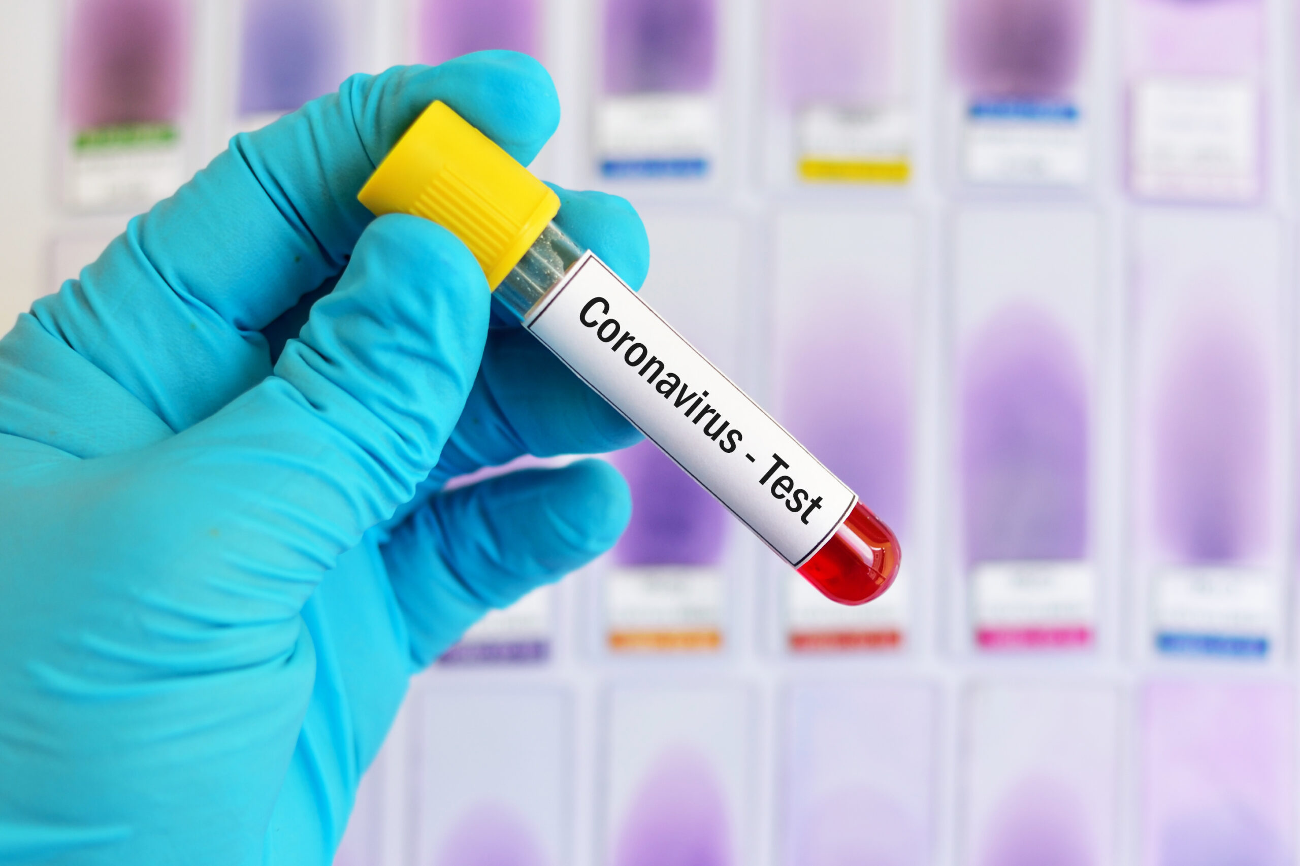 Image of sample for coronavirus test. Image credit: iStock