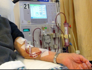 Man gets dialysis