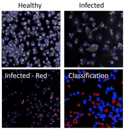 An example of U-M research on COVID-19: Images showing the response of human cells in a laboratory setting to treatment with different combinations of existing drugs. The approach, enhanced with artificial intelligence, aims to speed the discovery of new treatments. Image credit: Michigan Medicine