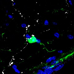 A sigh-control neuron (Neuromedin B positive) receives hypocretin inputs that regulate confinement stress-induced sighing in mice. Image credit: Peng Li, U-M Life Sciences Institute.