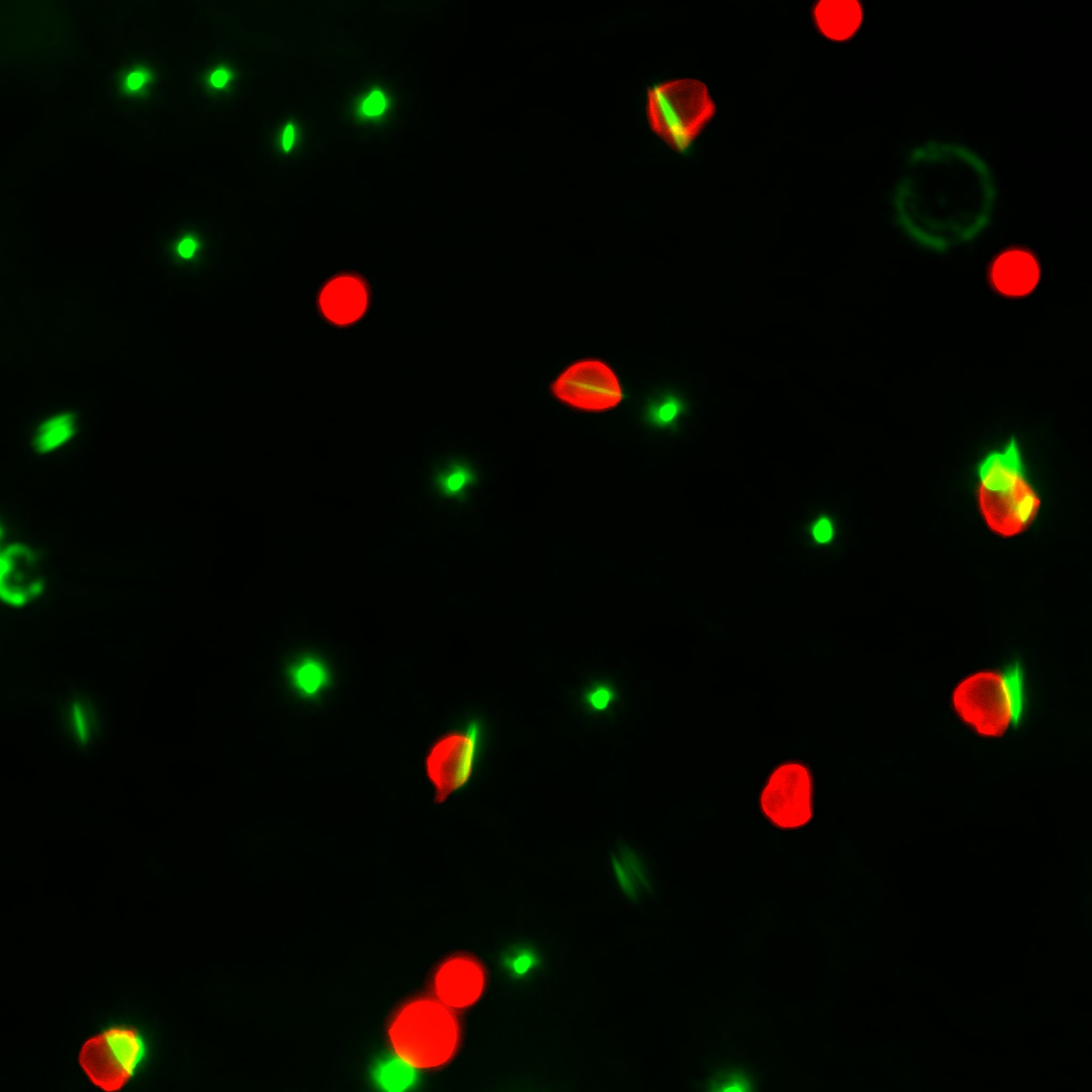 White blood cells called neutrophils, tagged with fluorescent red dye, eat spheres or rods that have been tagged with green dye. Because neutrophils are more willing to eat rods than are other immune cells, an injection of rod-shaped particles could be used to target neutrophils specifically. Earlier work in mice from the Eniola-Adefeso group suggests that injections of spheres can reduce excessive inflammation in the lungs. Image credit: Hanieh Safari, Eniola-Adefeso Lab, University of Michigan