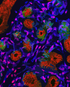 A Developing Mouse Lung.