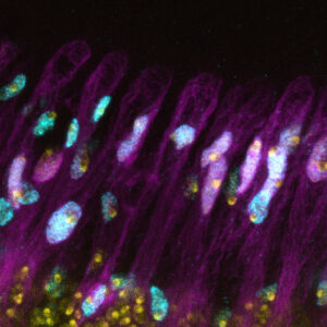 Glial cell marker in cyan and the cell nucleus in yellow. Image credit: Nandakumar et al. (CC BY 4.0)