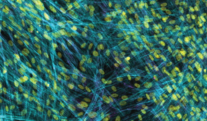 In line with prior work, myofibroblasts fail to accumulate in a soft 2d setting. Image is stained for cytoskeleton (blue), cell nuclei (yellow), and a marker for myofibroblast activation (alpha-smooth muscle actin, magenta). Image credit: Baker Lab