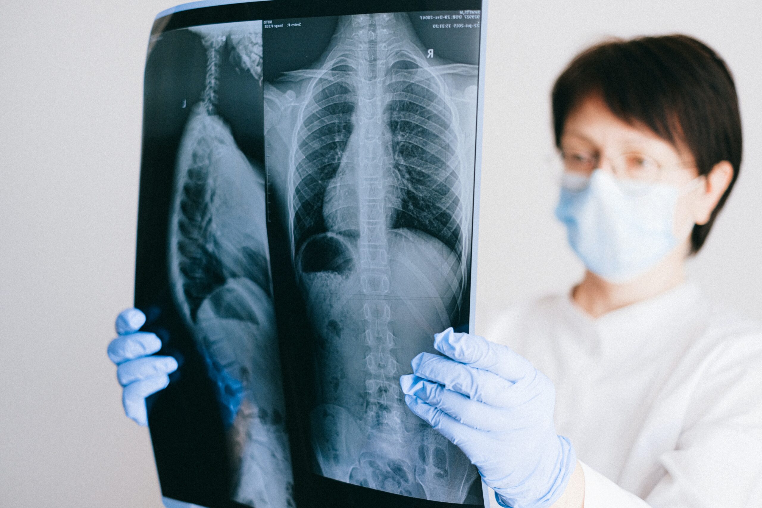 Person holding lung xray scan. Image credit: Pexels