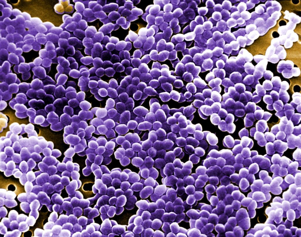 Microscopy image of Enterococcus faecalis. Image credit: Janice Haney Carr, USCDCP CC0