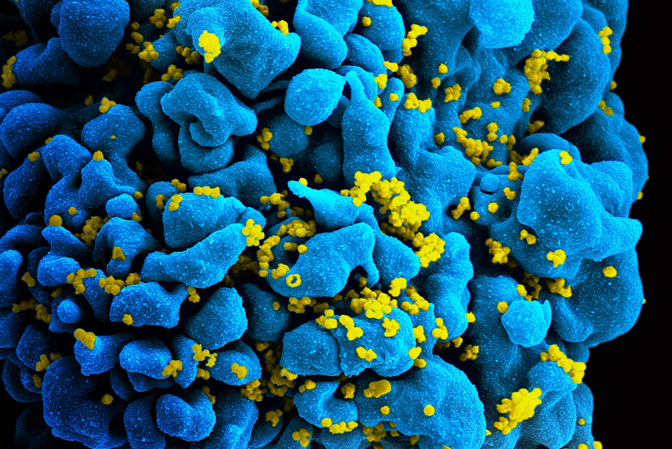 Scanning electromicrograph of an HIV-infected T cell. Credit: NIAID