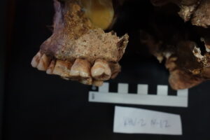 Dental calculus removed from the teeth of this individual showed evidence of dairy consumption. Image credit: Egor Kitov, Samara Valley Project