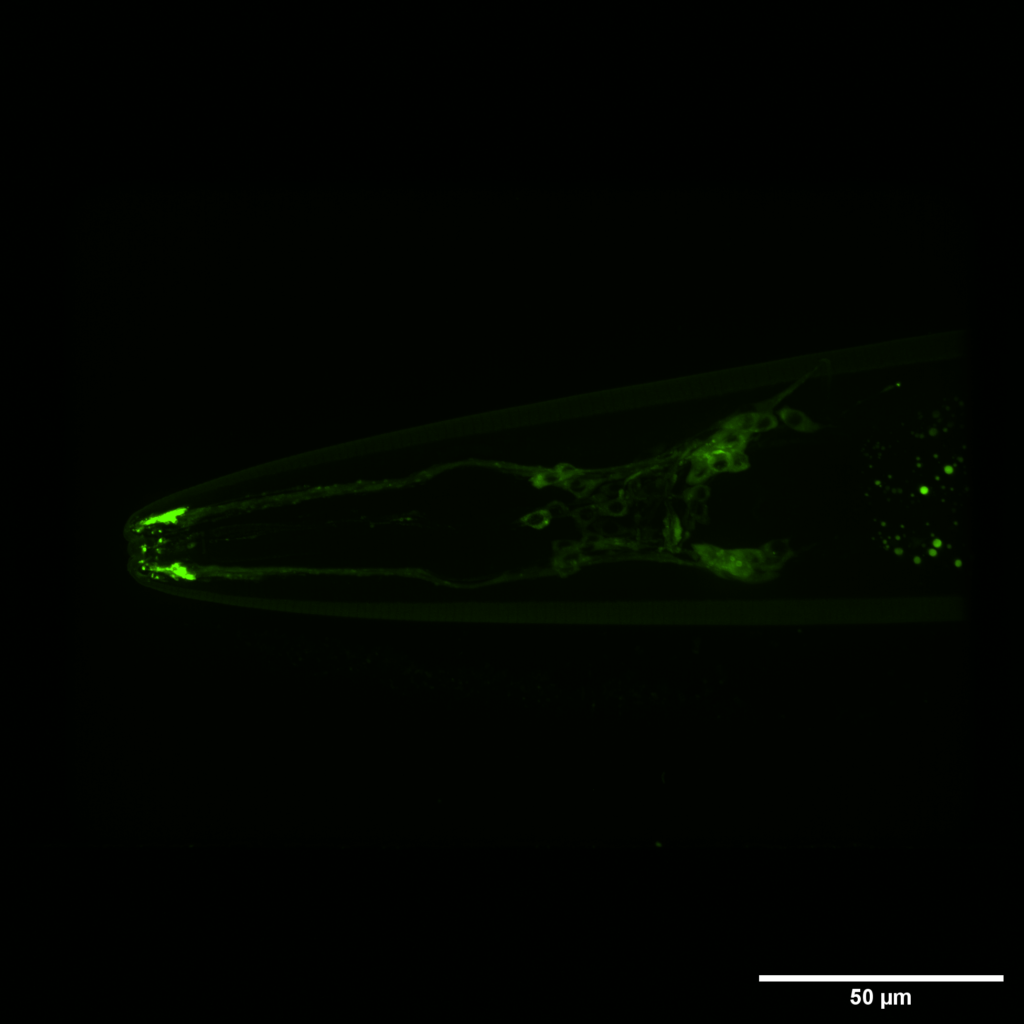 Using the model organism C. elegans, researchers have shown that a protein complex called the BBSome can function outside of cilia. Malfunctions in this protein complex lead to the human genetic disorder Bardet-Biedl syndrome. Here, BBSome (in green) is enriched at the tip of the C. elegan, where the cilia are, but also is expressed at other cellular locations, including neuron cell bodies. Credit: Xinxing Zhang, Ph.D., U-M Life Sciences Institute.