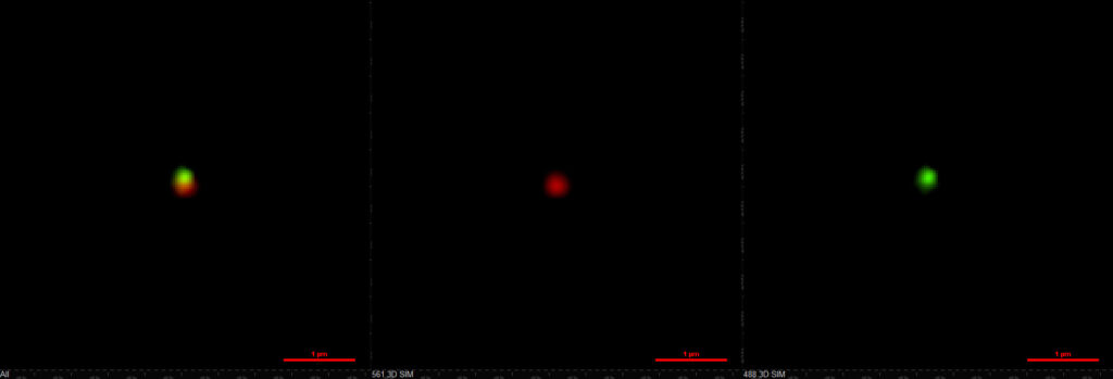 he two-compartment nanoparticles as seen with structured illumination microscopy. The green compartment contains the immune drug while the red compartment brings the tumor-killer. Credit: Ava Mauser and Nahal Habibi, Lahann Lab, University of Michigan.