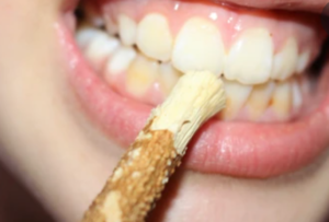 Yellow teeth