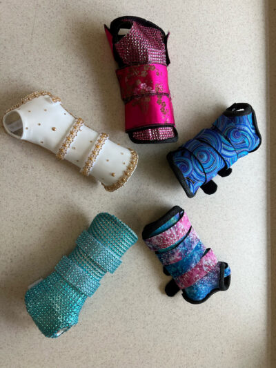 Some of the personalized hand splints designed by Augusta Simmons, a board-certified hand therapist who works at the Northville Health Center. (Courtesy photo)