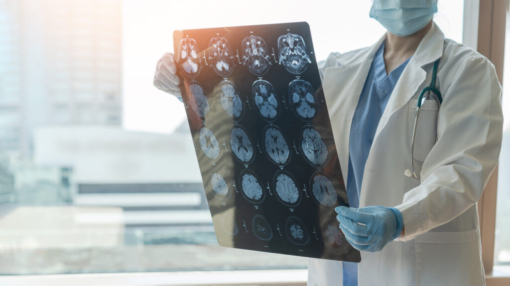 A doctor examines an MRI. Image credit: iStock