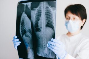 Doctor with mask and gloves reads a lung xray.