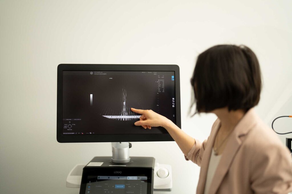 Zhen Xu, Professor of Biomedical Engineering, points to a bubble cloud generated by the Edison Platform’s transducer head during a histotripsy demonstration at HistoSonics. Image credit: Erica Bass, Rogel Cancer Center, Michigan Medicine