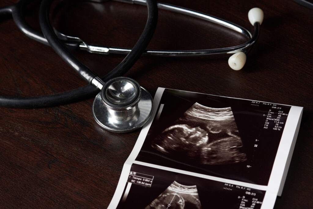 Close-up of stethoscope and ultrasound scan on wooden background. Image credit: dimarik, iStock