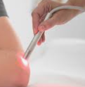 Laser treatment on elbow