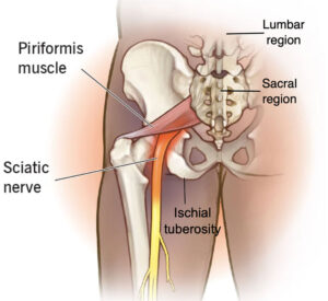 Graphic that shows sacral region, sciatic nerve, in the human body