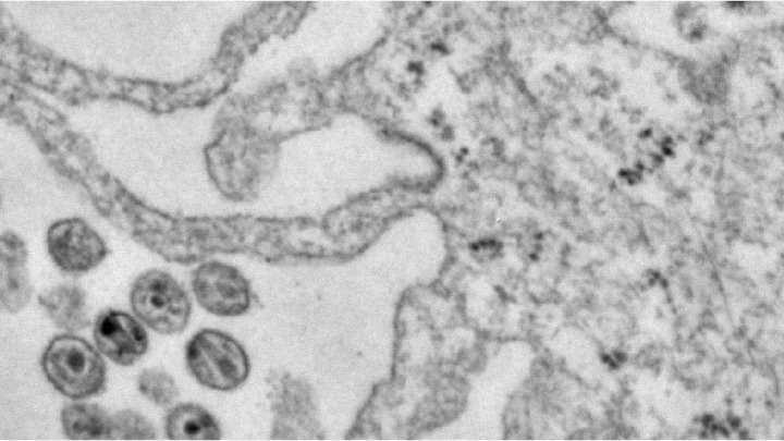 Electron microscope image of viral particles produced in HIV-infected human immune cells (macrophages). Image credit: Kathleen Collins and Michael Mashiba