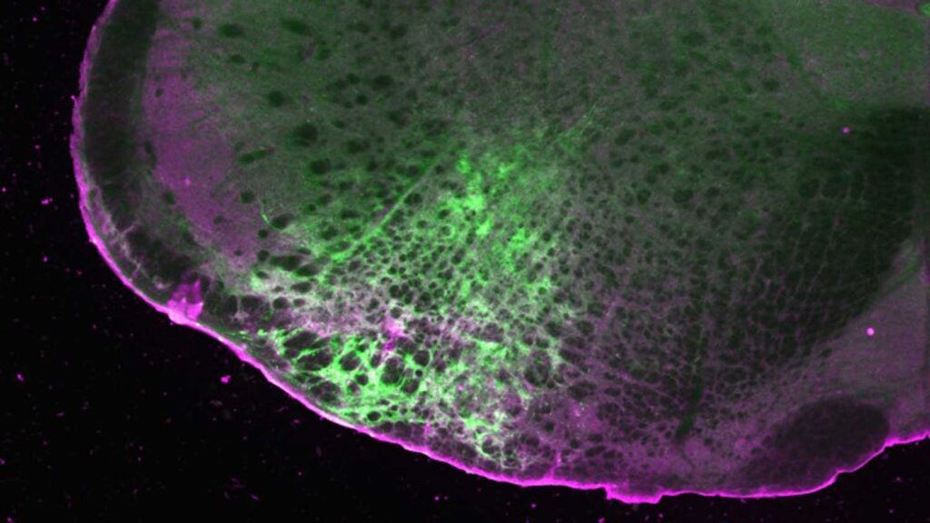 A slice of the mouse brainstem demonstrates the detection of morphine (green) and the expression of the SPOTIT sensor (magenta). Image credit: Noam Gannot and Peng Li, U-M Sciences Institute