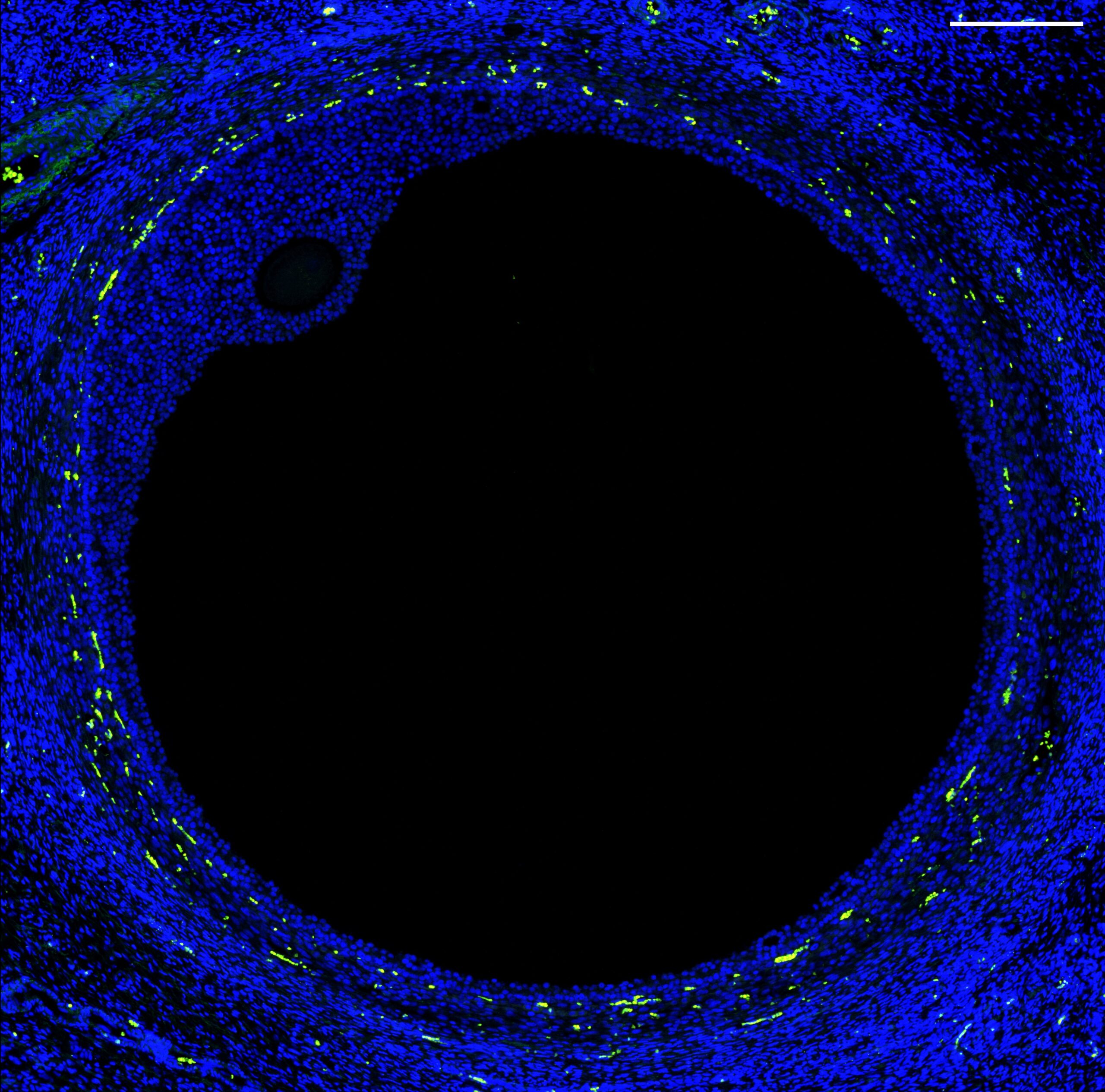 A large black circular disc takes up most of the square image, with a smaller black oval disc hugging its edge. Their relative sizes are similar to a pea and a poppy seed although the larger disc is only about a millimeter across. Both are outlined in blue, cells lit up with fluorescent markers. Yellow dots trace out circles around the large disc.
